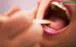 Có cách nào chữa ung thư vòm họng giai đoạn cuối?