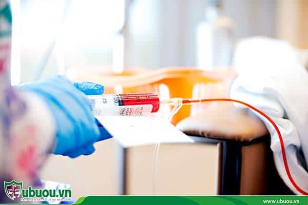 Hóa trị thường được áp dụng chủ yếu với các phương pháp khác để tăng tính hiệu quả Hóa trị sử dụng thuốc để tiêu diệt tế bào ung thư gan