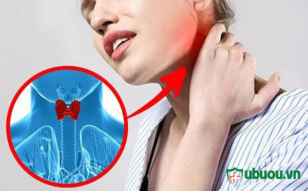 biểu hiện của bệnh u tuyến giáp là đau vùng cổ