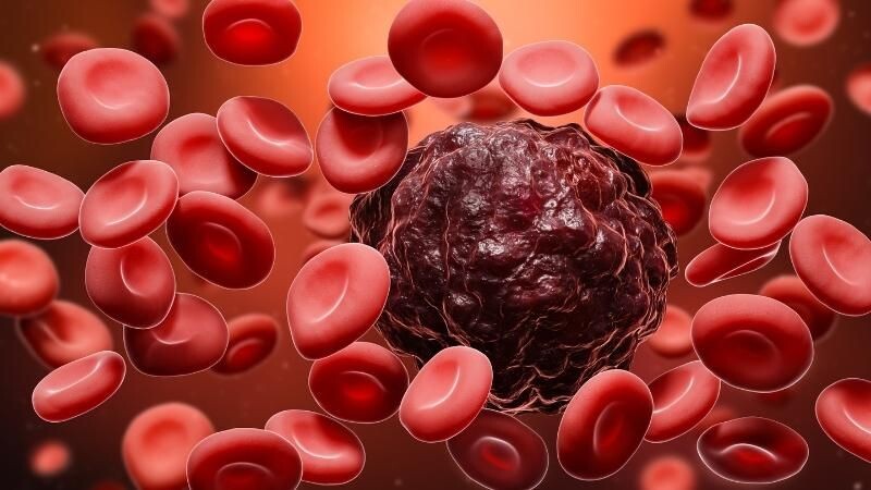 Chữa bệnh ung thư máu ở đâu an toàn và hiệu quả?