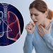 Những dấu hiệu ung thư phổi sớm và cách phòng bệnh