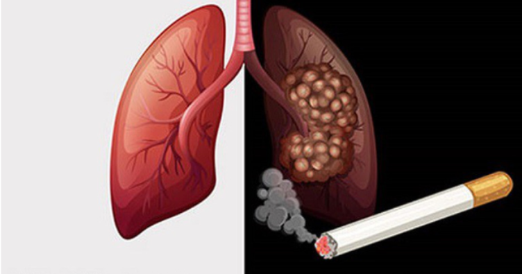 Tại sao hút thuốc lá có thể gây ung thư phổi?